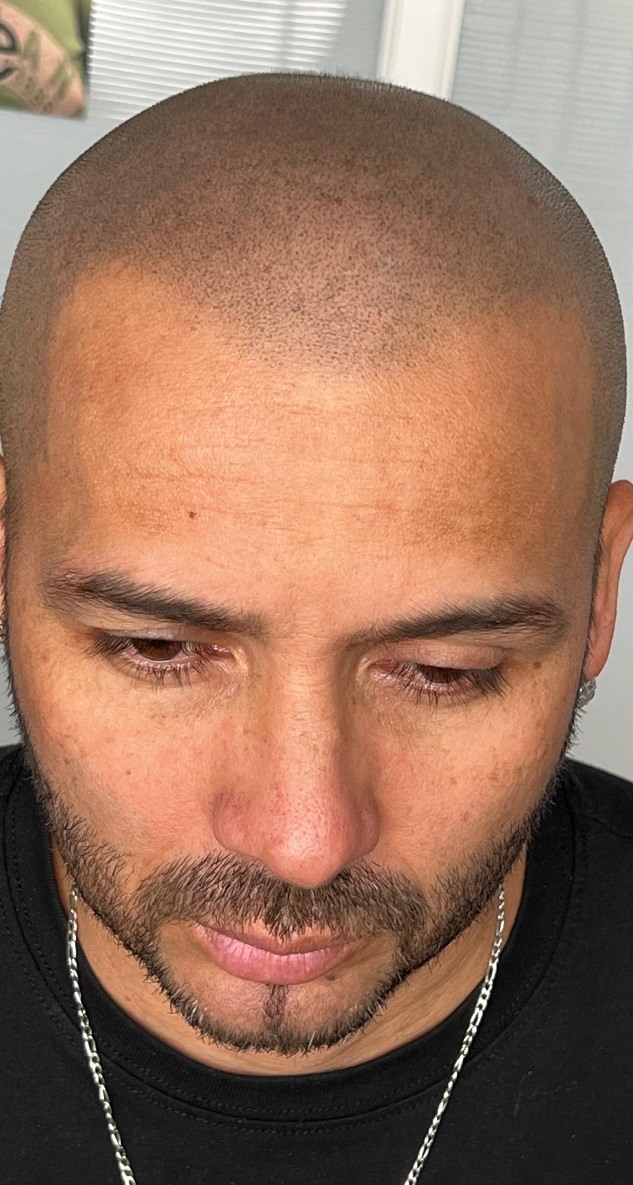 Caso 3 Después